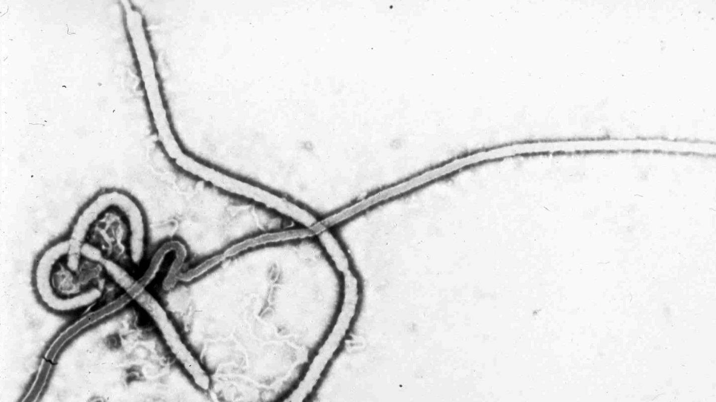 Il virus Ebola è simile al virus di Marburg (Ansa)