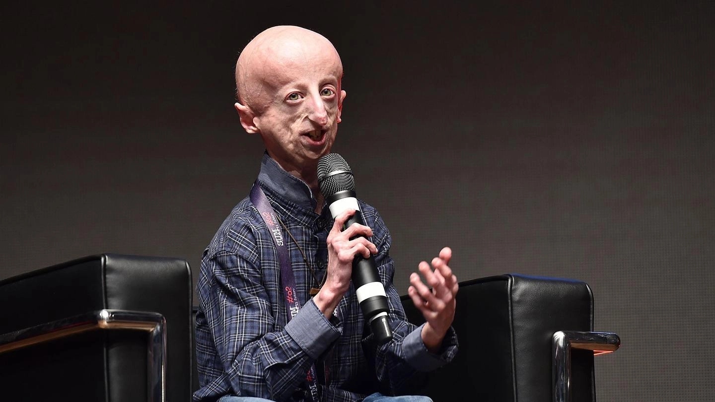 Sammy Basso, 23 anni, malato di progeria (Ansa)
