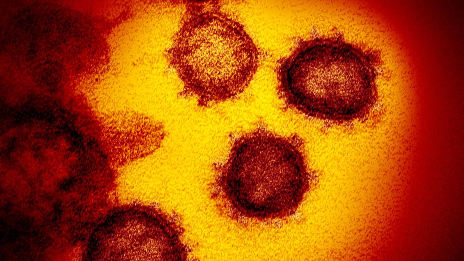 Il virus Sars-CoV2 (Ansa)