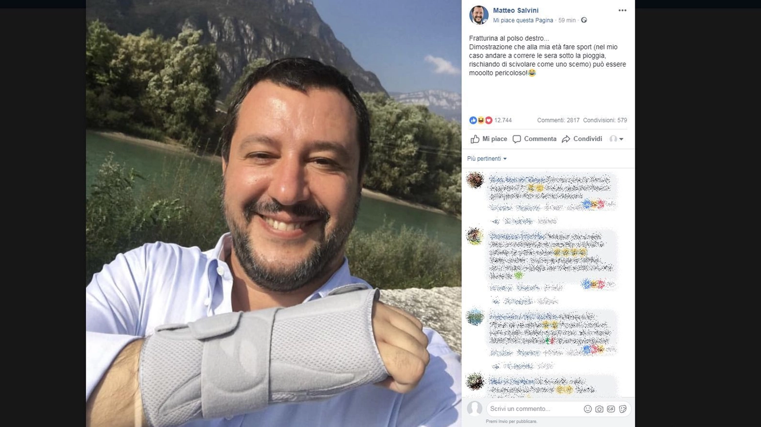 Matteo Salvini con il tutore al polso su Facebook
