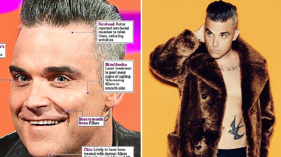 Robbie Williams e il botox nella pagina del Mail Online. A destra una foto Instagram