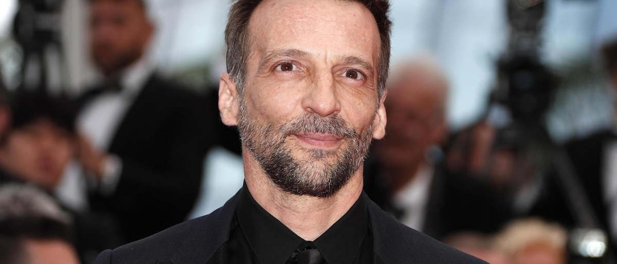 For Kassovitz serious fractures but not life threatening