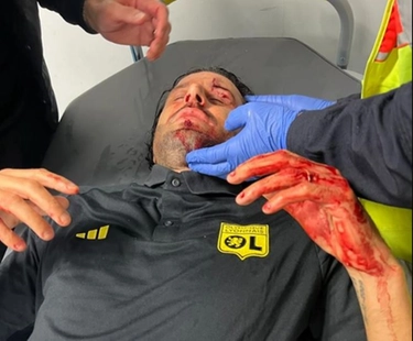 Incidenti a Marsiglia, Fabio Grosso ferito da una pietra: la partita contro il Lione non si gioca