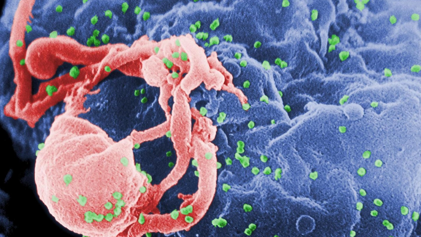 Il virus dell'Hiv al microscopio (Ansa)