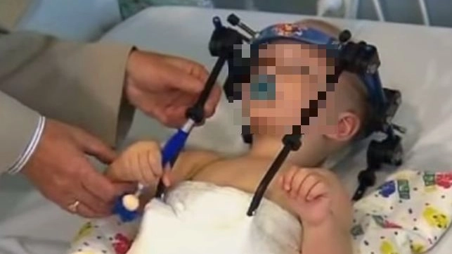 Il piccolo Jackson Taylor dopo l'operazione alle due vertebre (da youtube)