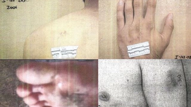 Combo foto torture pubblicate dal Pentagono (da sito aclu.org) 