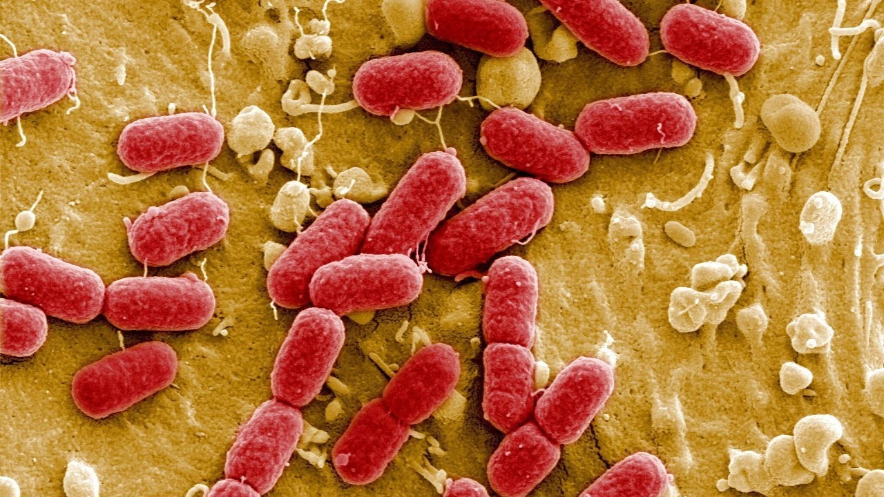 Batteri resitenti agli antibiotici (Ansa)