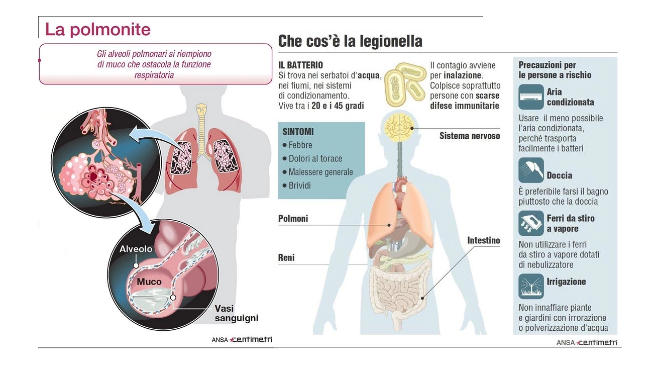 Legionella e polmonite (Centimetri)