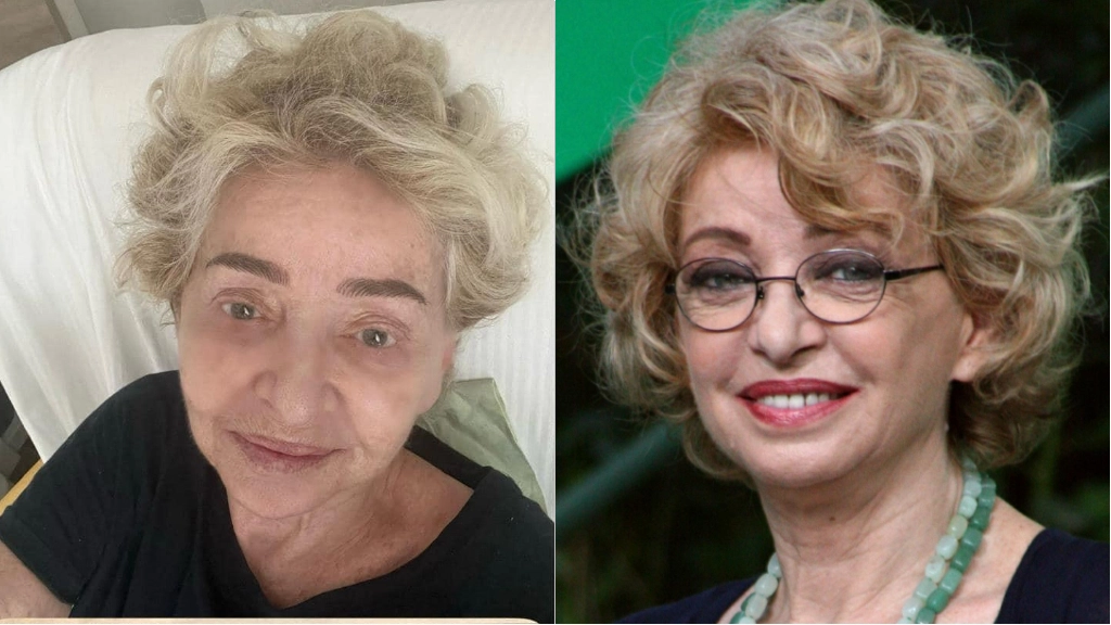 Enrica Bonaccorti: a sinistra la foto scattata in ospedale dopo l'operazione al cuore