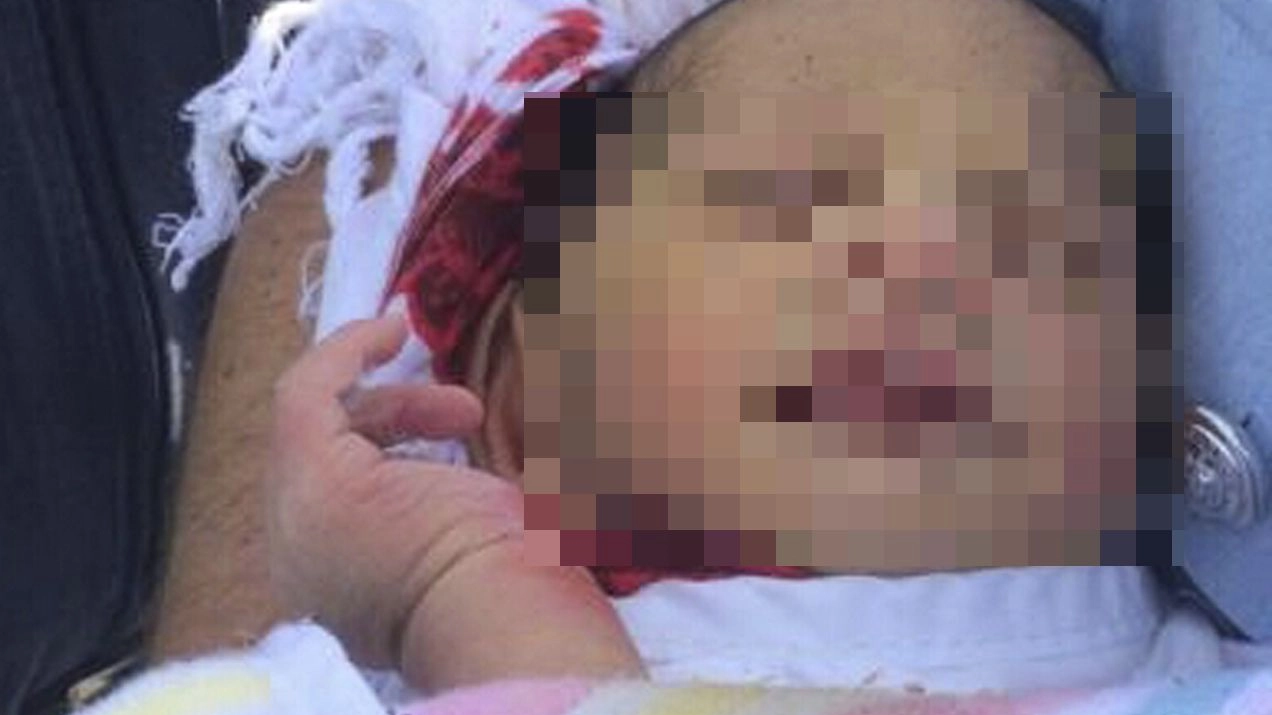 Il neonato trovato vivo in una fossa dopo 5 giorni, Australia (Ap/Lapresse)