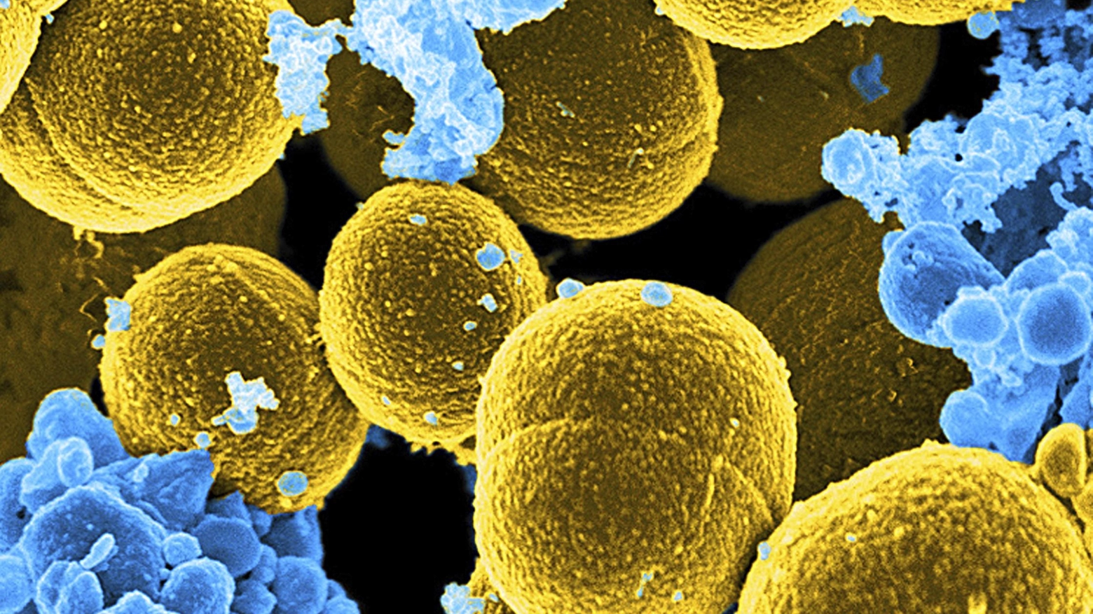 Batteri e antibiotici (Ansa)