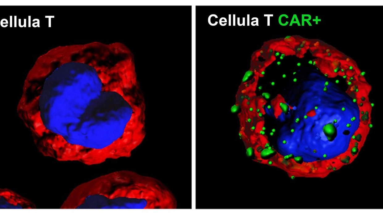 La cellula linfocita T prima e dopo la modifica genetica (Ansa)