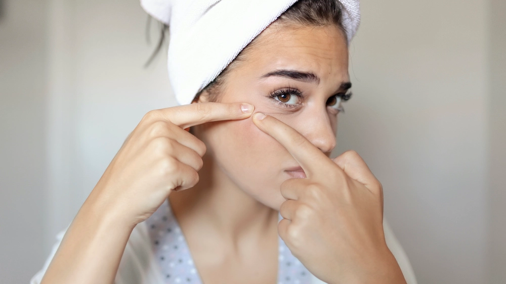 Le cause meno conosciute dell'acne