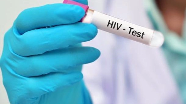 Test per il virus Hiv