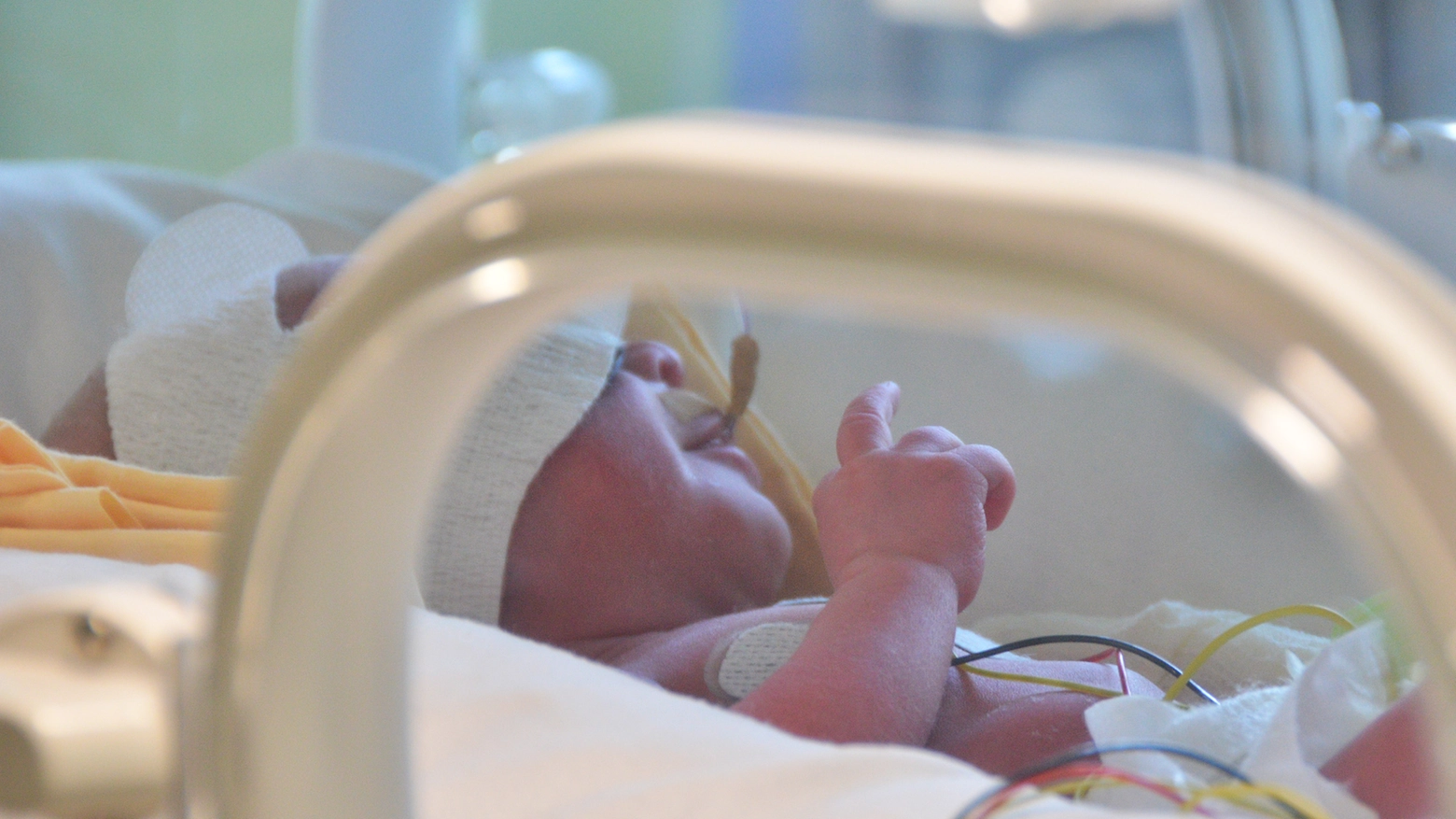 Neonato prematuro in incubatrice (foto generica)