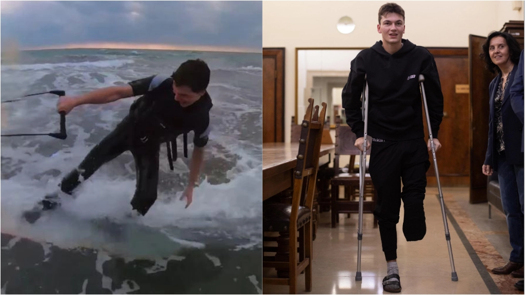 Il 20enne di Parma è tornato a fare wakeboard con l’aiuto di una protesi. Il 9 dicembre l’incidente in Australia che gli è costato una gamba. Dopo tre interventi chirurgici, il trasferimento al Rizzoli di Bologna