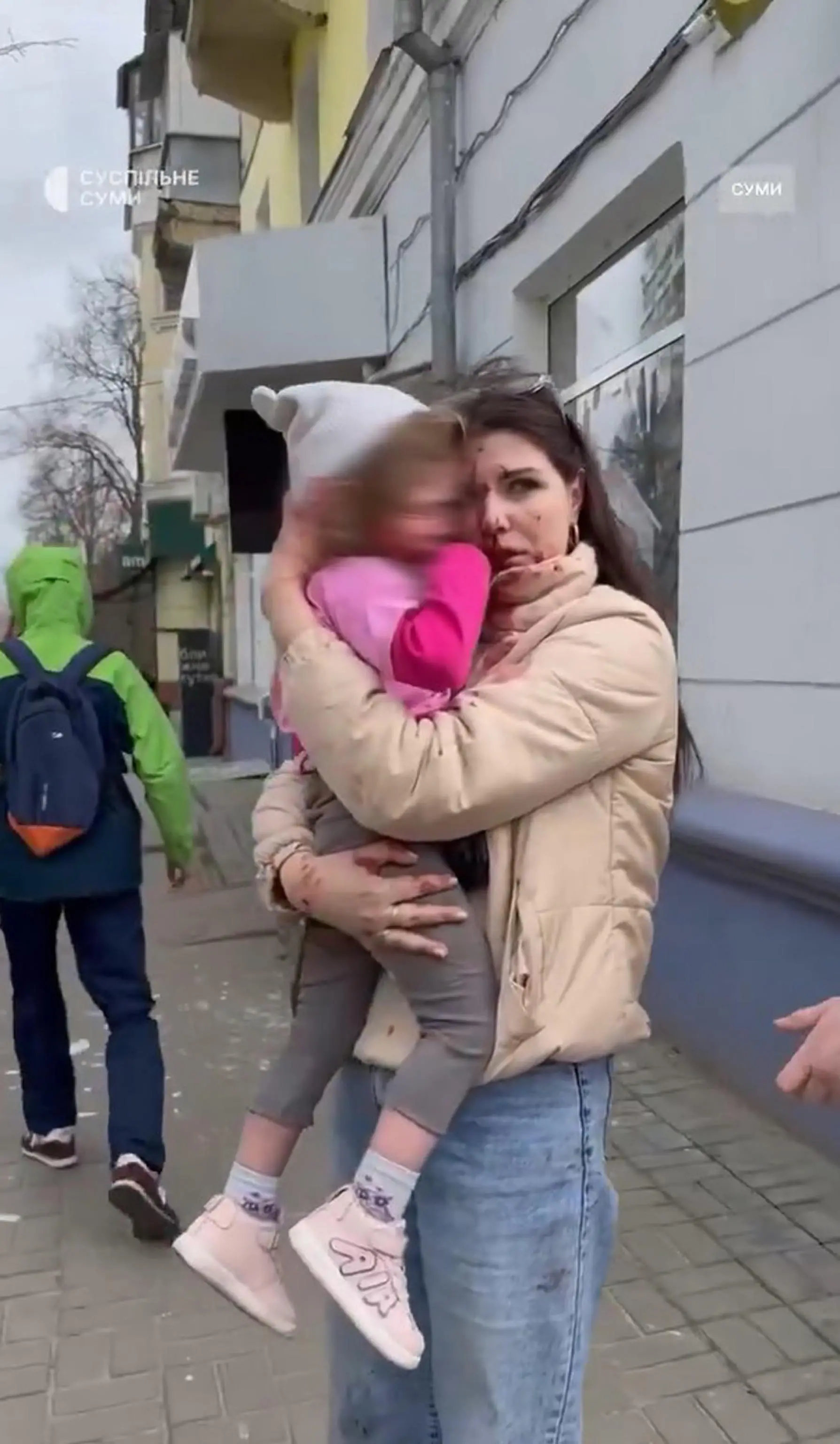 Il pianto della bimba di Sumy commuove il mondo: “Mamma, mi hanno colpito”