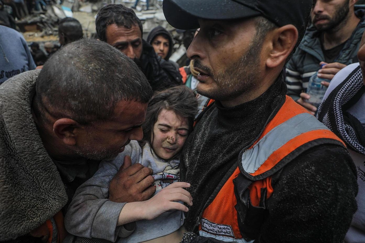 Una bambina rimasta ferita durante i raid israeliani sul sud della Striscia di Gaza