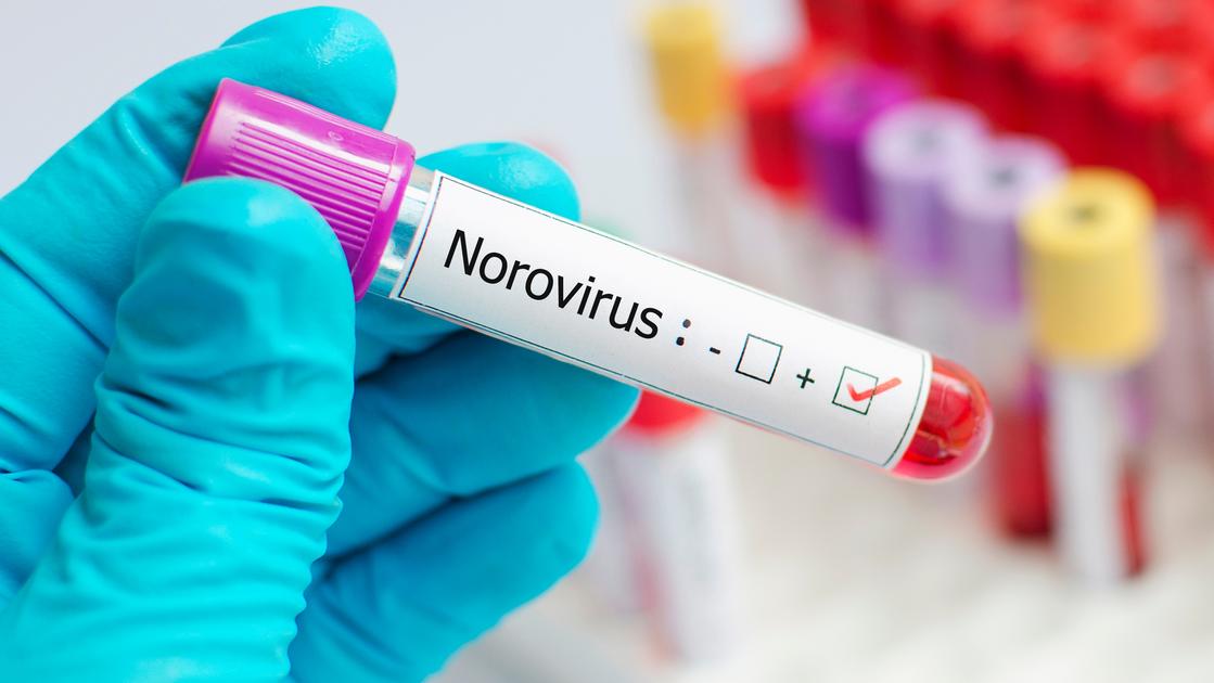 Come Norovirus 