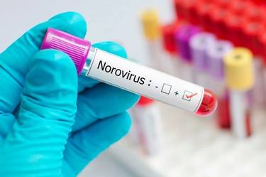 Norovirus, al Passo del Tonale vietato l’uso potabile dell’acqua. I sintomi e come si trasmette