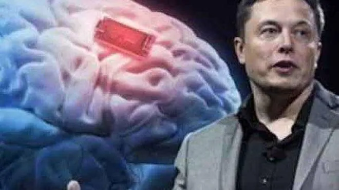 L’imprenditore Elon Musk, 49 anni, ha fondato la start up Neuralink nel 2016