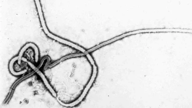 This undated electron micrograph image provided by the Centers for Disease Control and Prevention on May 11, 1995 shows the Ebola virus. In a report released Friday, May 1, 2015, health officials think Ebola survivors can spread the disease through unprotected sex nearly twice as long as previously believed. (CDC via AP)