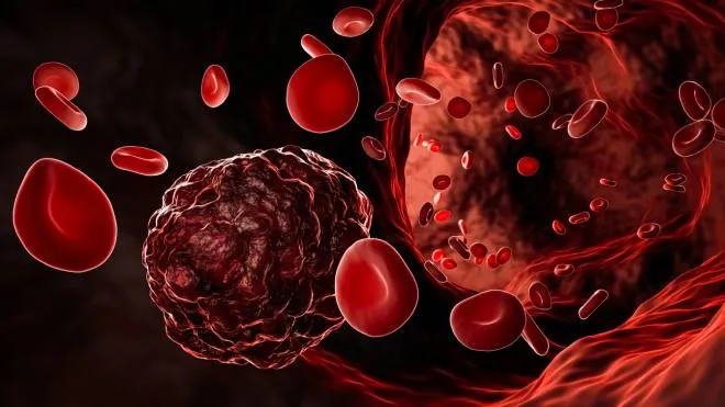 Le cellule tumorali vanno in circolo nel sangue
