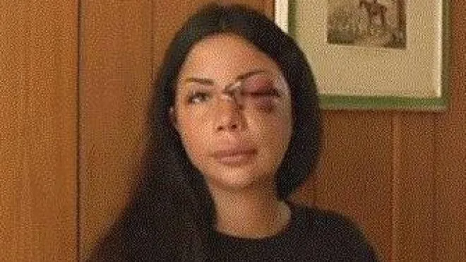 Martina Mucci, 28 anni, la cameriera aggredita mentre stava rientrando a casa