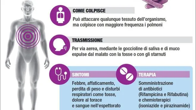 Salvini, tubercolosi tornata a diffondersi. Scheda sulla tubercolosi in un'infografica realizzata da Ansa-Centimetri, Roma, 12 settembre 2018. ANSA/CENTIMETRI