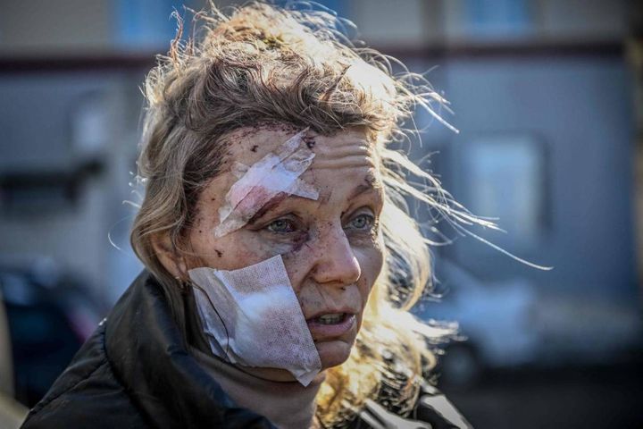 Chuguiv, donna ferita fotografata vicino all'ospedale (Ansa)