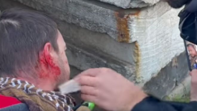 Il giornalista Locatelli ferito (frame dal video Facebook di Claudio Locatelli)